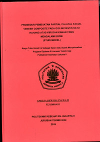 Prosedur Pembuatan Partial Palatal Facial Venner Composit pada gigi Incisivus Satu Rahang Atas Kiri dan Kanan Atas yang mengalami Erosi (Studi Model)