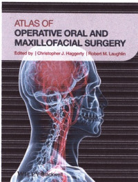 Atlas Of Operative Oral And Maxillofacial Surgery