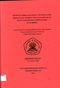 Prosedur pembuatan Partial Denture Rahang Bawah Kelas  1 Kennedy pada kasus  Maloklusi kelas 2 Dan Ekstrusi Caninus kanan (STUDI MODEL)