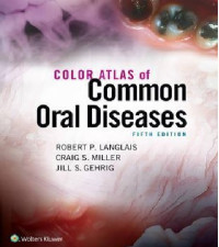 Color Atlas of Oral Diseases
