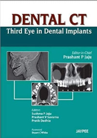 Dental CT Third Eye In Dental Implant