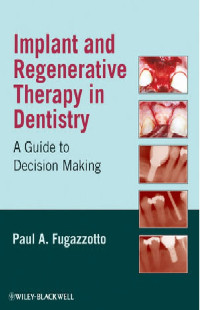 Implant and Regenerative Therapy in Dentistry A Guide to  Decision Making