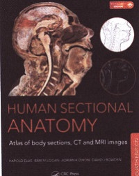 Human  sectional  anatomy atlas of body sections, ct and MRI images