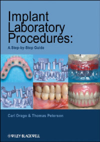 Implant Laboratory Procedures: A Step-by-Step Guide