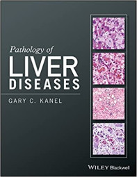 Pathology of Liver Diseases