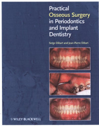 Image of Practical Osseous Surgery In Periodontics And Implant Dentistry