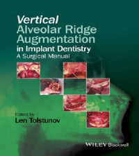 Vertical Alveolar Ridge Augmentation in Implant Dentistry A Surgical Manual
