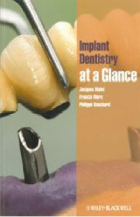 Implant Dentistry  at a Glance