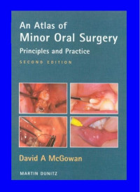 An Atlas of Minor Oral Surgery Principles and Practice