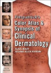Fitzpatrick's Color Atlas And Synopsis Of Clinical Dermatology Sixth Edition