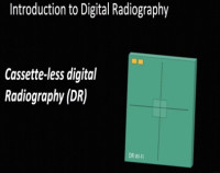 Digital Radiography