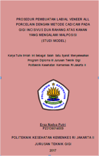 Prosedur Pembuatan Labial Veneer All Porcelain dengan Metode CAD/CAM Pada Gigi Incisivus Dua Rahang Atas Kanan Yang Mengalami Mal Posisi (Studi Model)