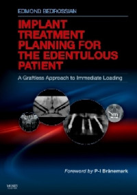 Implant Treatment Planning For The Edentulous Patient A Graftless Approach to Immediate Loading