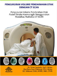 Pengukuran Volume Pendarahan Otak dengan CT Scan