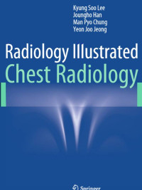 Radiology Illustrated: Chest Radiology